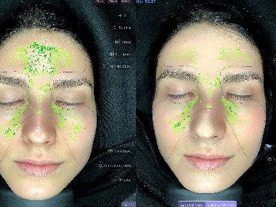 Top 3 Skin Analyzer Machines for Professional Use in 2025