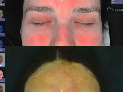 What Makes a Good 3D Face Analyzer Manufacturer