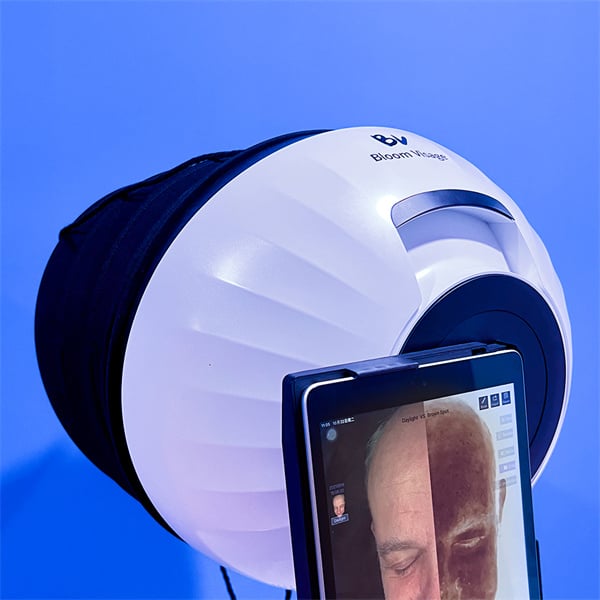 How to Perform Accurate Skin Analysis