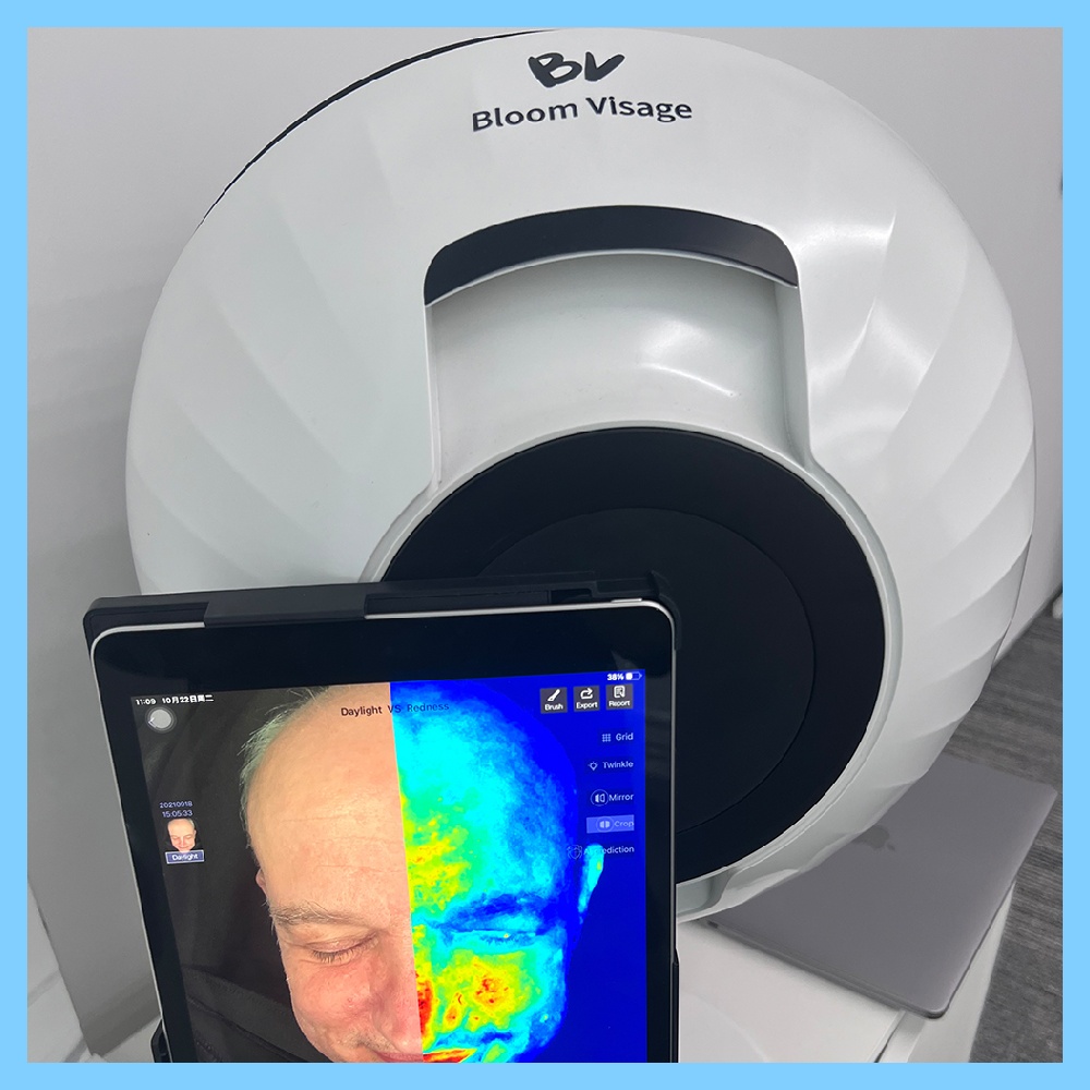Unlocking the Power of AI for Optimal Skin Health