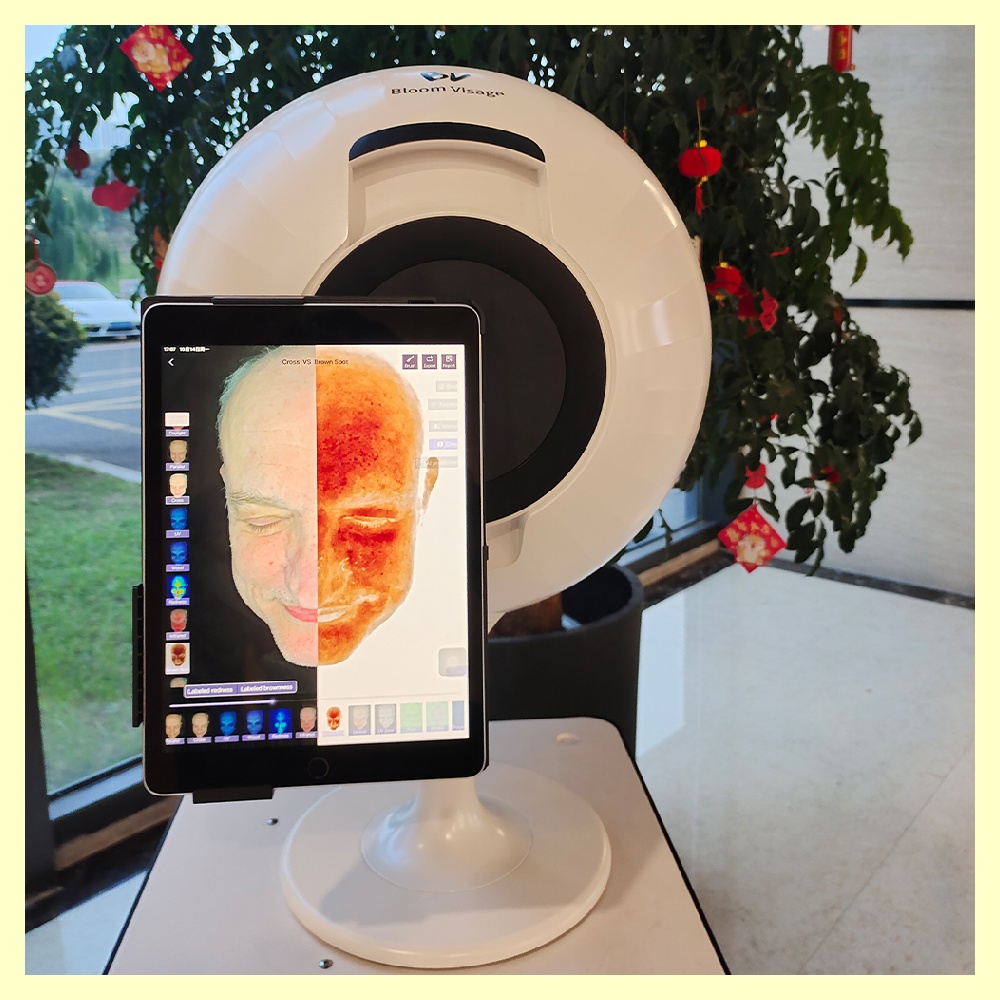 The Benefits of 3D Skin Analysis