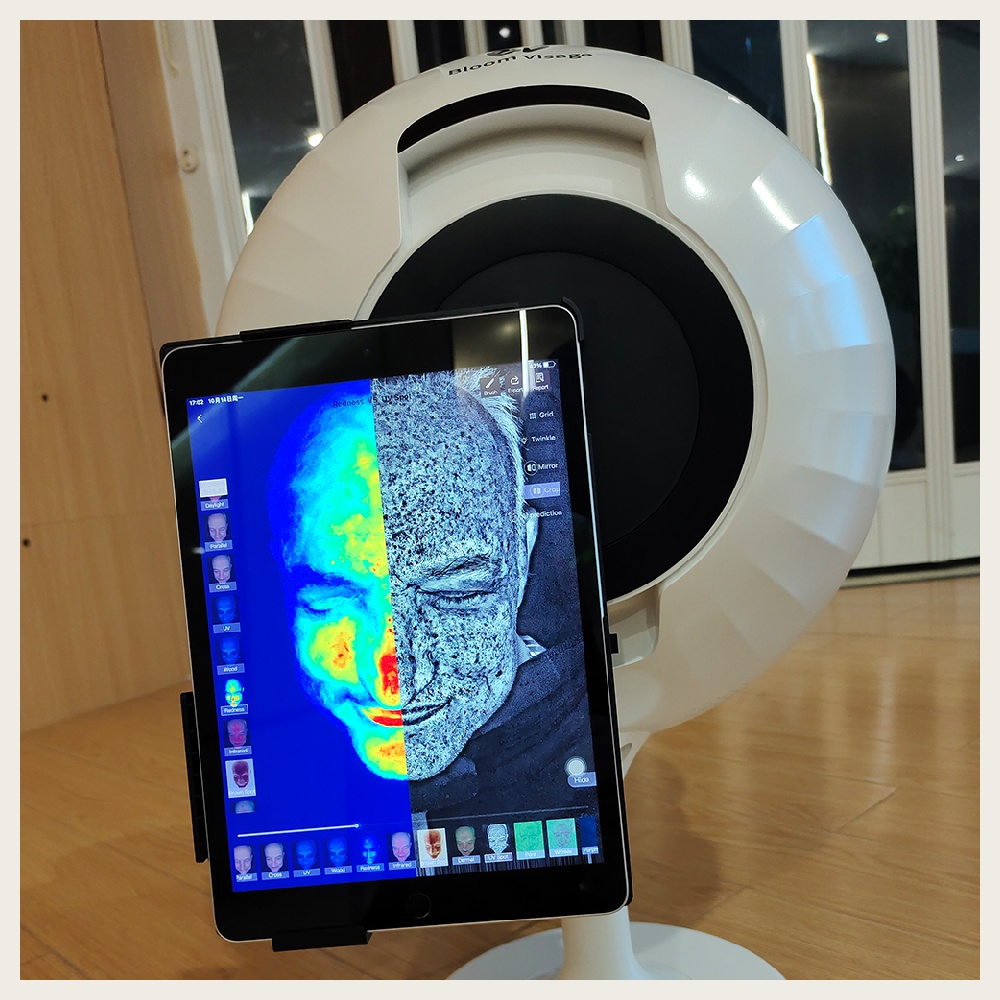 Transforming Skin Care through Intelligent AI Skin Analysis