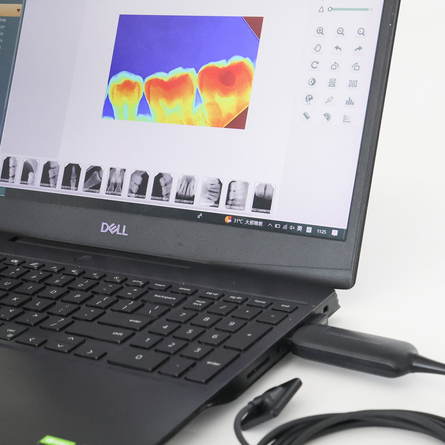 Mejorando la calidad y la velocidad en prótesis dentales con sistemas CAD CAM