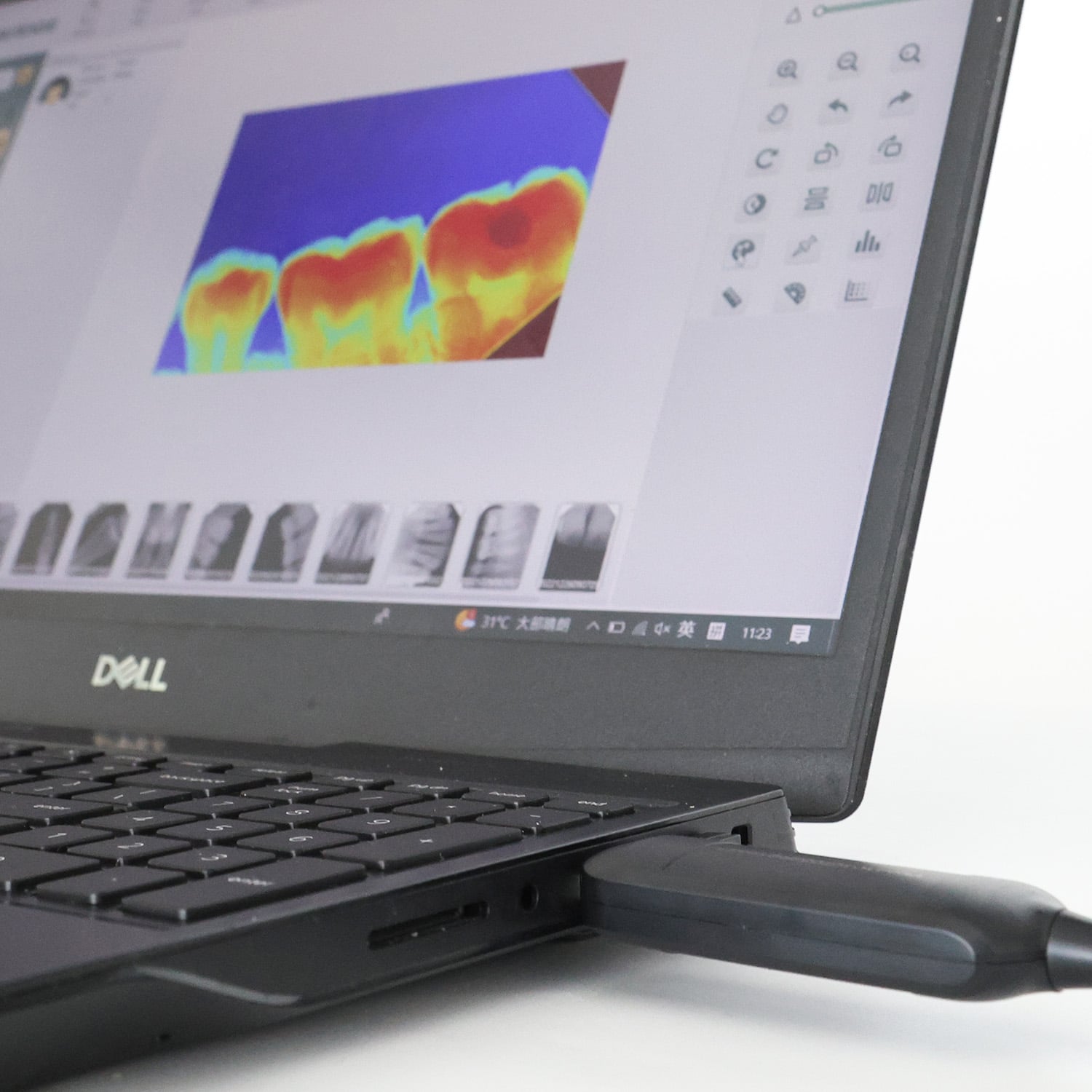 Consejos para prolongar la vida útil de sus sensores digitales de radiografía dental