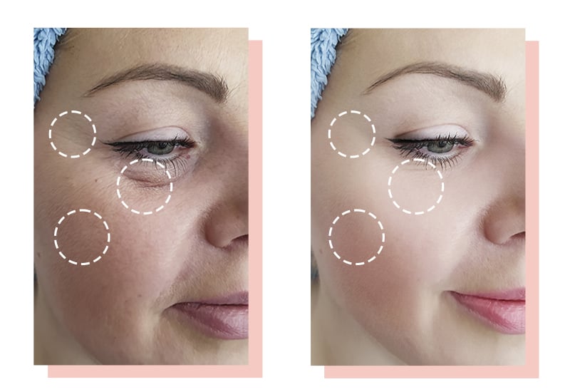 Four-color light therapy 42-degree constant-temperature heating deep skin rejuvenation beauty device manufacture