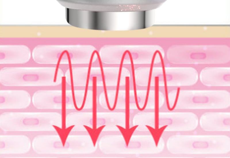 Face Lift Pro Beauty Care Device Re-educate Facial Contours Beauty Equipment 3MHz Ultrasonic supplier