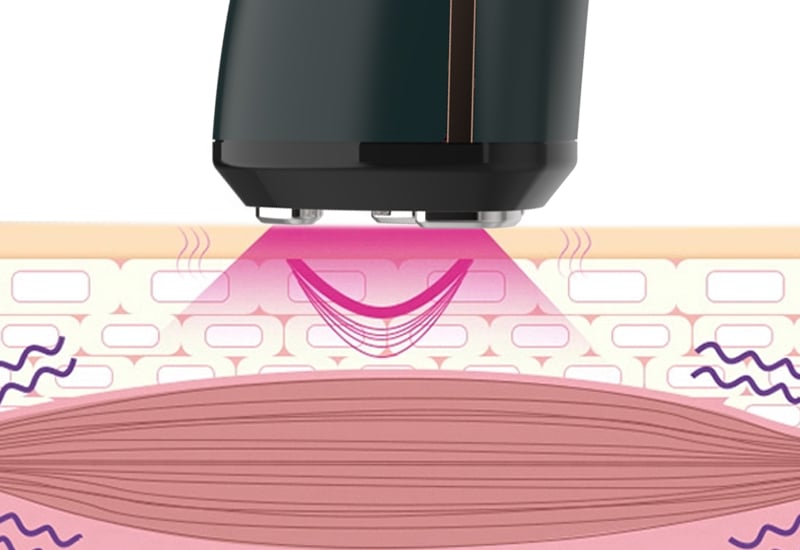 RF Face Lifting Device Face Massager Beauty Device Home Use Beauty Equipment supplier
