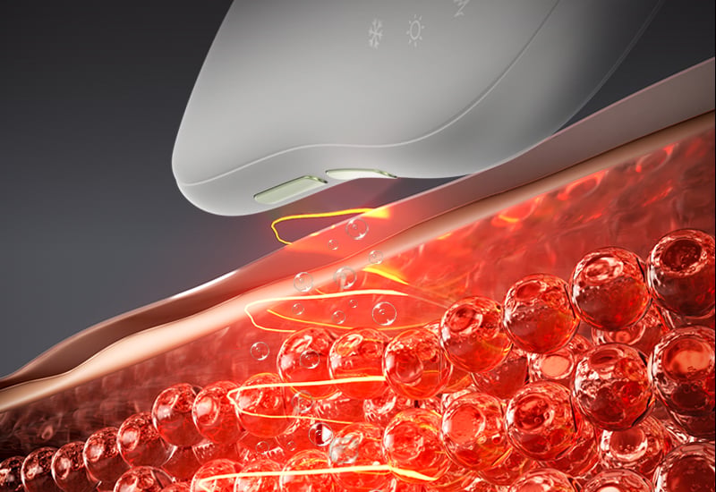 Salon-Grade Home Skincare 4-In-1 Facial Massager Hot&Cold Therapy Vibration lonic Microcurrent Beauty Equipment factory