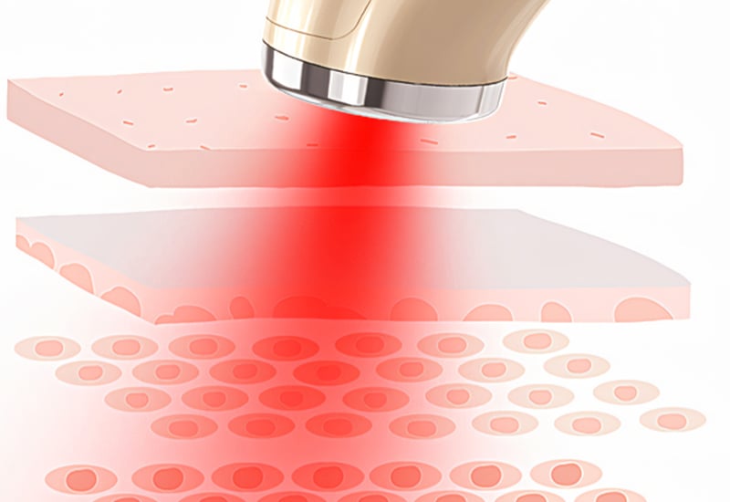 3 in 1 Skincare Revolution System Ultrasonic multifunctional class beauty device manufacture