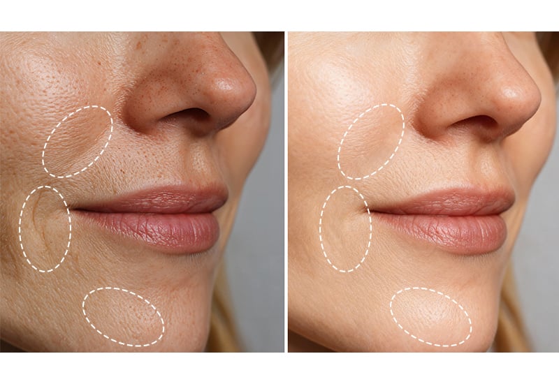Multifunctional 4-color hot and cold therapeutic beauty skin care device manufacture