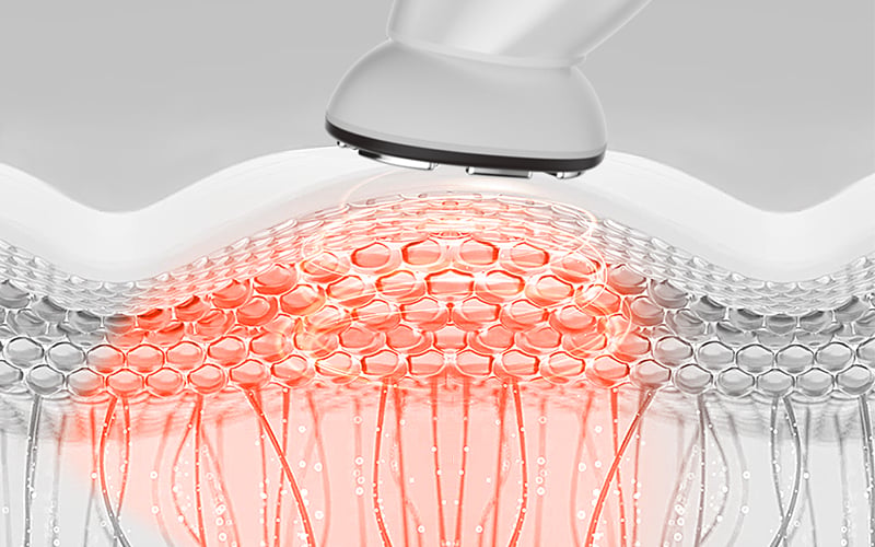 Multifunctional Rf Face Lifting Machine Skin Tightening Face Massager Beauty Personal Care Products factory