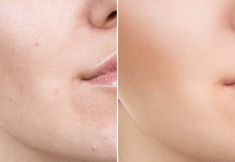Face Lift Pro Beauty Care Device Re-educate Facial Contours Beauty Equipment 3MHz Ultrasonic details