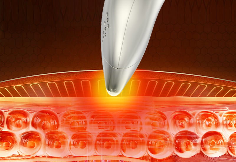 Multifunctional 4-color hot and cold therapeutic beauty skin care device details