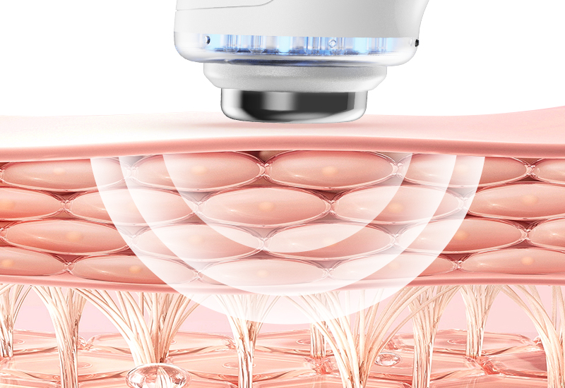 Face Lift Pro Beauty Care Device Re-educate Facial Contours Beauty Equipment 3MHz Ultrasonic manufacture