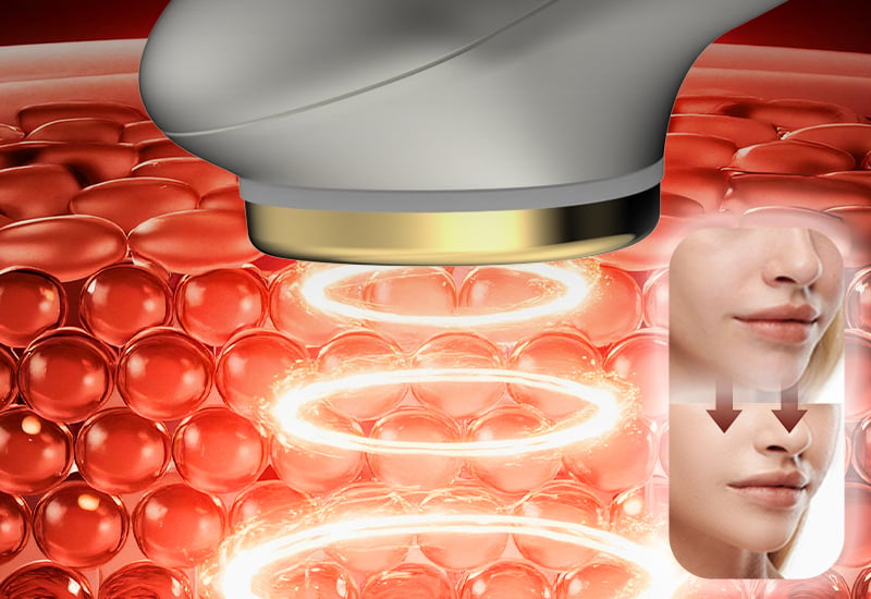 Four-color light therapy 42-degree constant-temperature heating deep skin rejuvenation beauty device factory