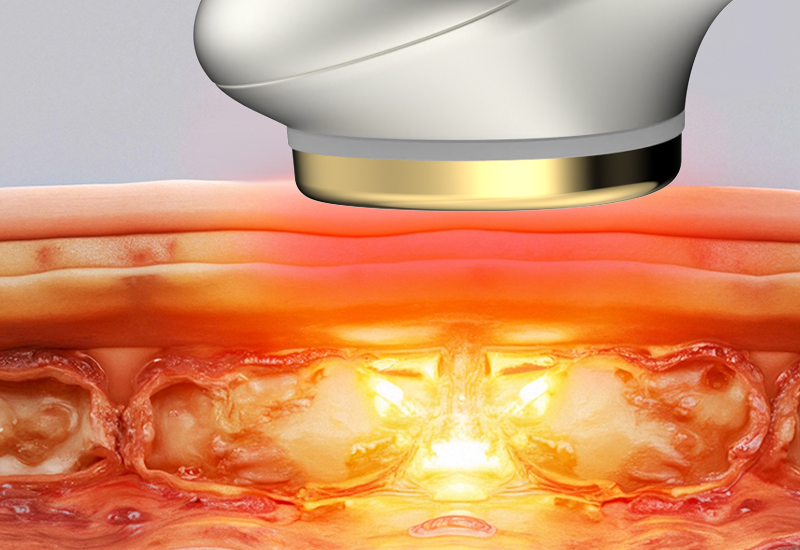 Four-color light therapy 42-degree constant-temperature heating deep skin rejuvenation beauty device manufacture