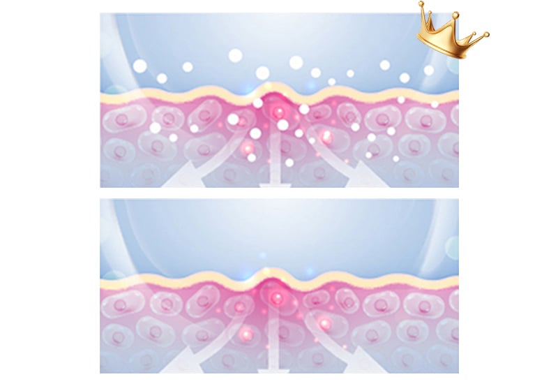 EMS Rolling Warm Massager 3D Massage Rollers Innovatively-designed with microcurrent treatment manufacture