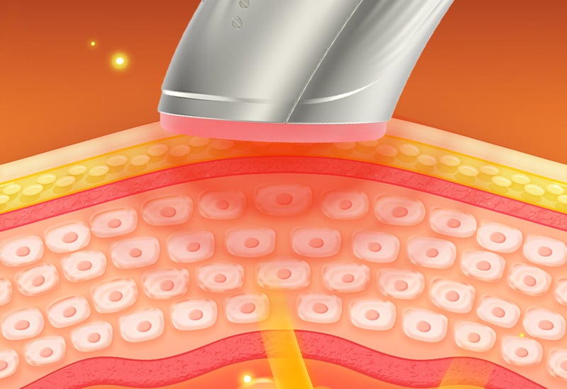 4-Color Laser Phototherapy Anti-aging beauty device supplier