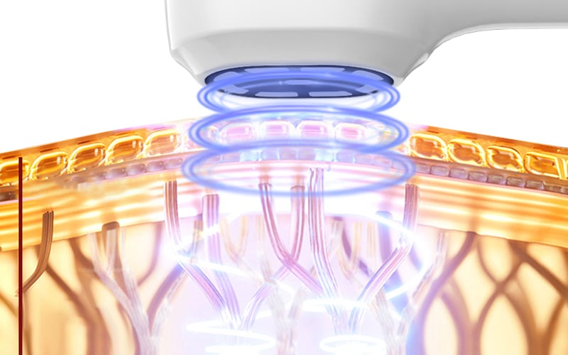 High Frequency Vibration Cooling Skin Tightening Beauty Device details