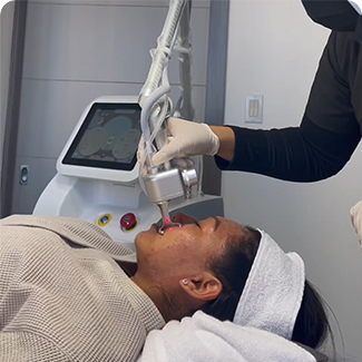fractional co2 laser machine extra solo-8