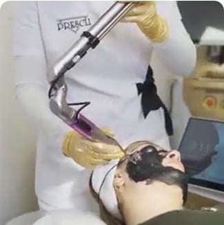 q switch nd yag laser free rigin-7