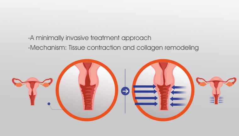 Treatment Mechanism