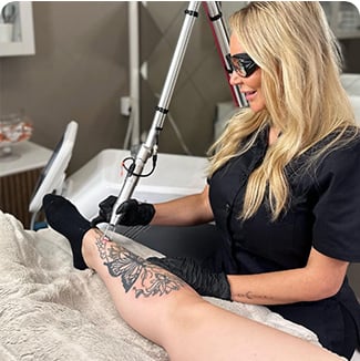 q switch nd yag laser free rigin-10