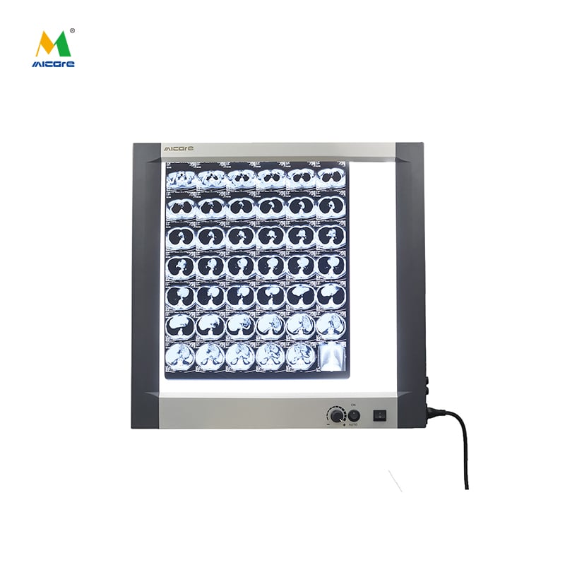 ضوء مشاهدة أحادي الارتباط بسعر منخفض لآلة مشاهدة الأفلام الشعاعية السينية OEM MICARE MG-01X