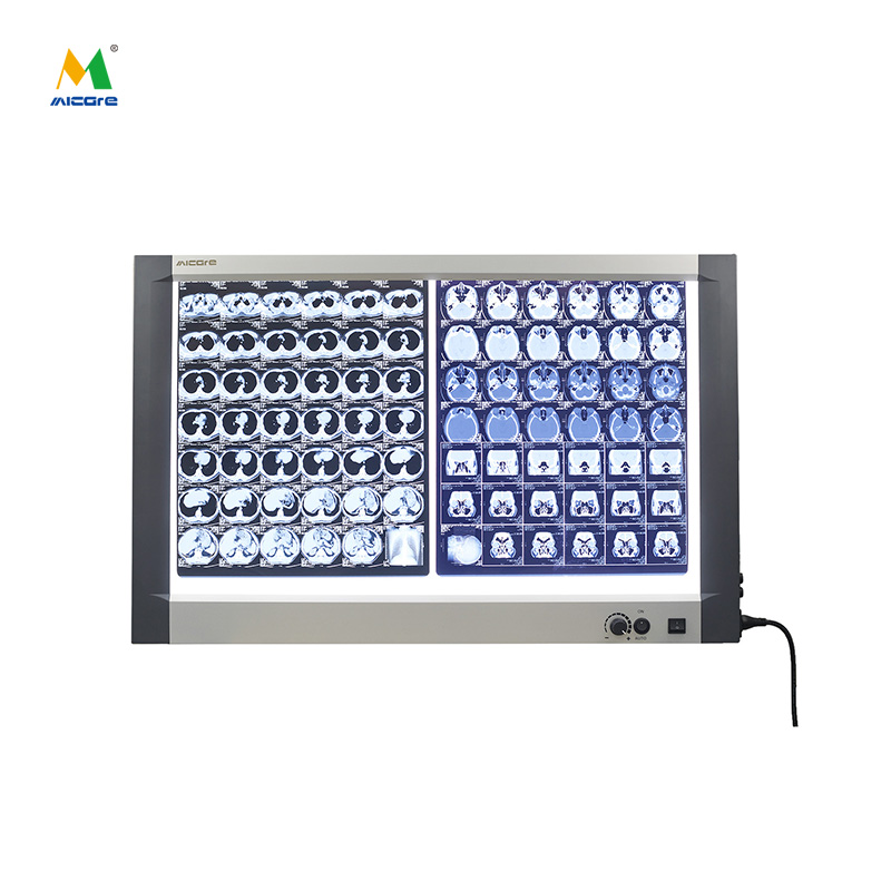 Micare Ultra-Thin X-ray Viewer Light Box: The Perfect Combination of Digital and Knob Models