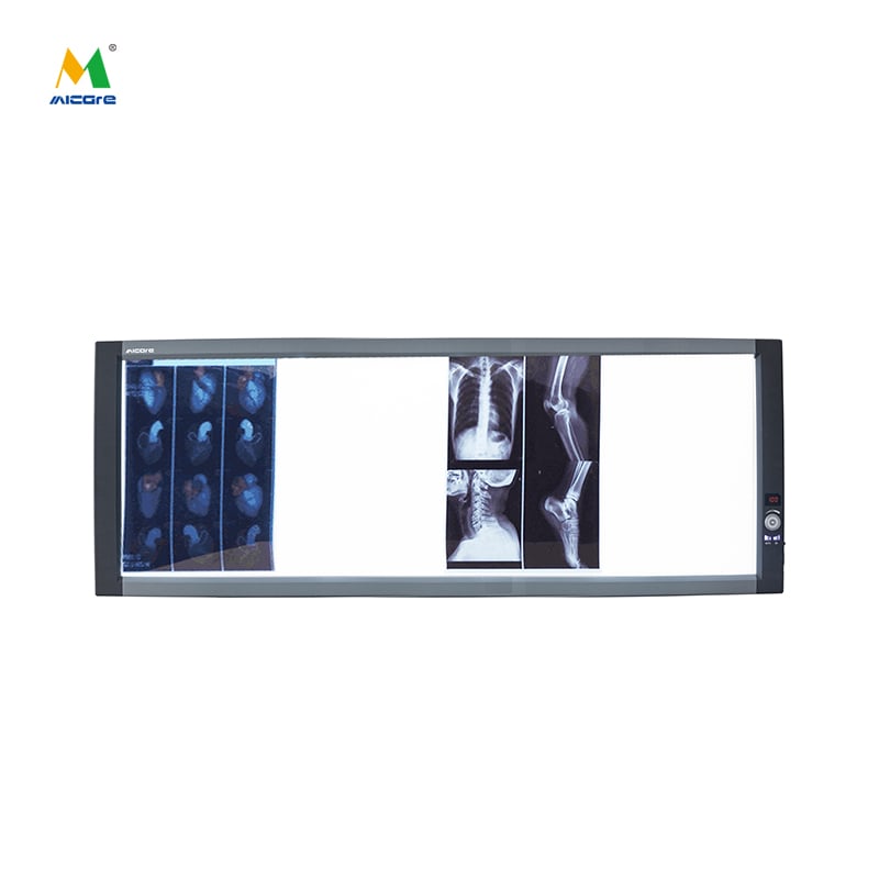 ميكار رباعي (ZG-4C) LED Negatoscope مشاهدة الأشعة السينية الطبية المحدثة لضوء المشاهدة