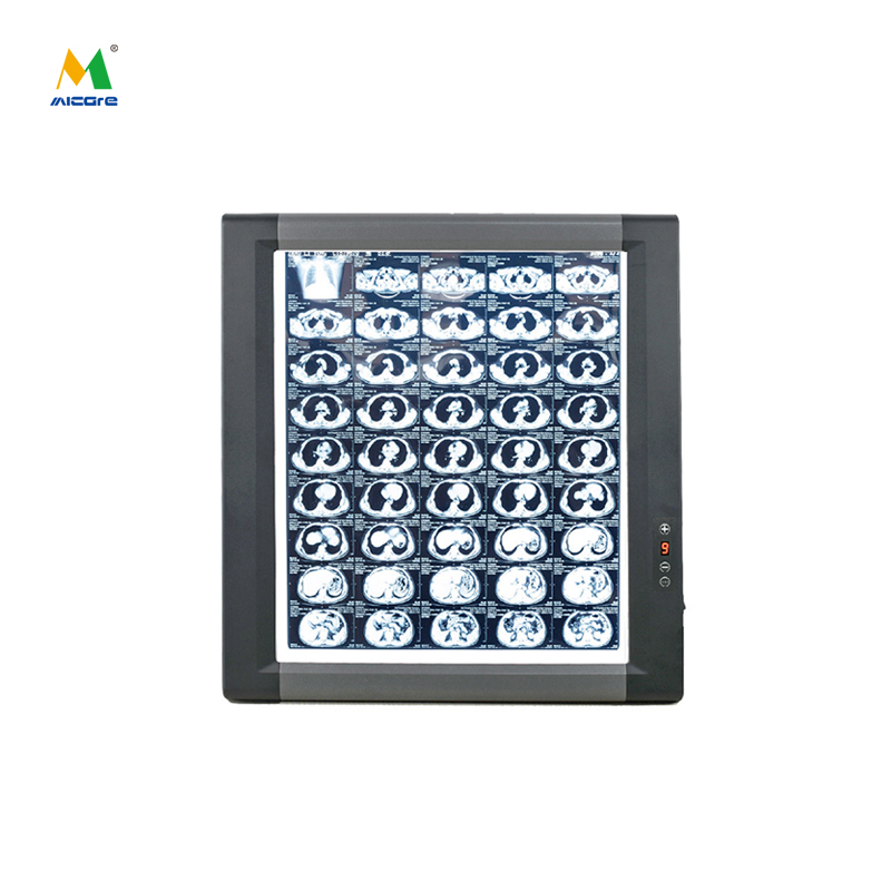 How to choose a suitable X-ray fluoroscope