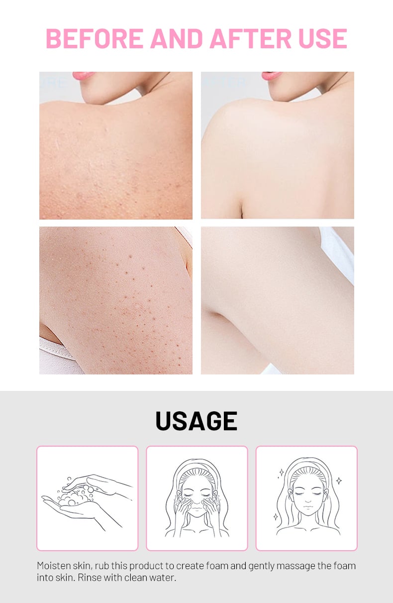 DS5604 Disaar Niacinamide Brightening Cleansing Soap - 100g, Handmade with Coconut Oil Extract, Moisturizing & Lightening, Reduces Acne Scars, Body & Face Soap manufacture