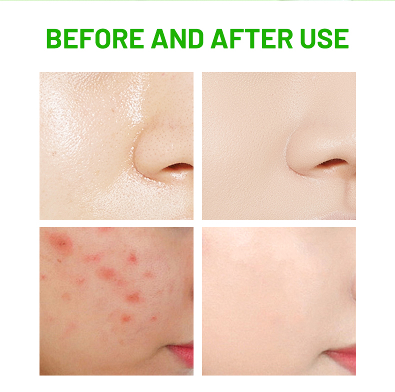 DS5731 100g Rosemary & Centella Asiatica Facial Wash - Revitalizing & Calming Cleanser for All Skin Types | LivePro Beauty factory