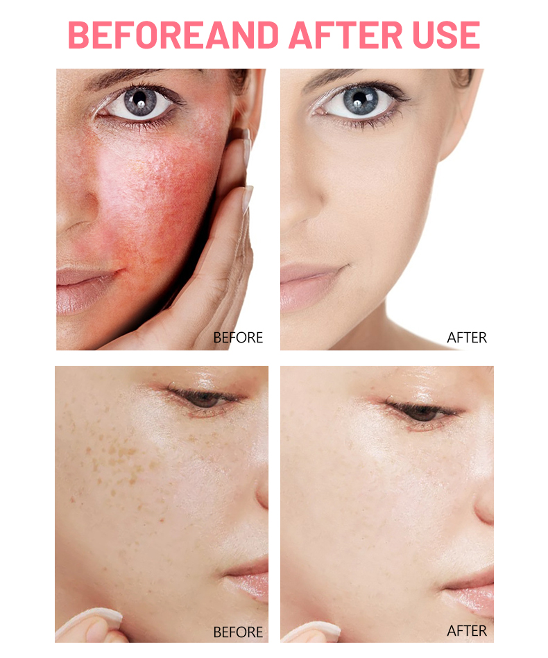 DS5304 50g Rose & Ceramide Facial Cream - Hydrating & Repairing Moisturizer for All Skin Types | LivePro Beauty manufacture