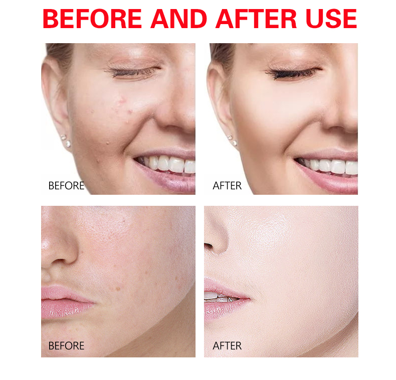 DS5254 50g Pomegranate & Vitamin E Facial Cream - Antioxidant-Rich Moisturizer for Radiant Skin | LivePro Beauty details