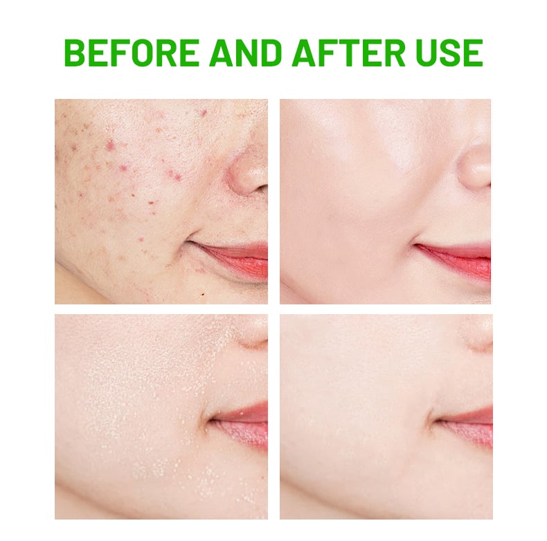 DS5734 50g Rosemary & Centella Asiatica Facial Cream - Revitalizing & Calming Moisturizer for All Skin Types | LivePro Beauty manufacture
