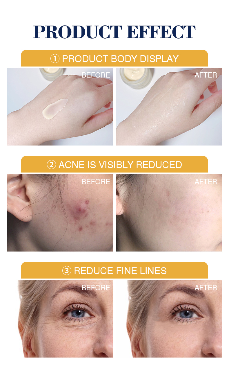 GJ7053 Guanjing Herbal Turmeric Anti-Aging Cream - 50ml, Organic Turmeric Extract, Anti-Wrinkle, Anti-Spots, Acne Scar Removal, Whitening & Pore Minimizing Face Cream factory
