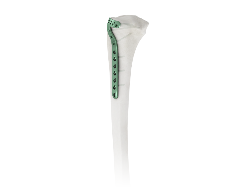 The Role of Precision Engineering in Today’s Trauma Implant Systems