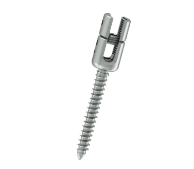 What Are the Signs of Bone Screw Failure or Complication?