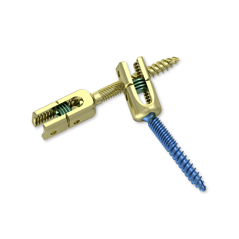How Does a Bone Screw Support Bone Healing After Fracture?