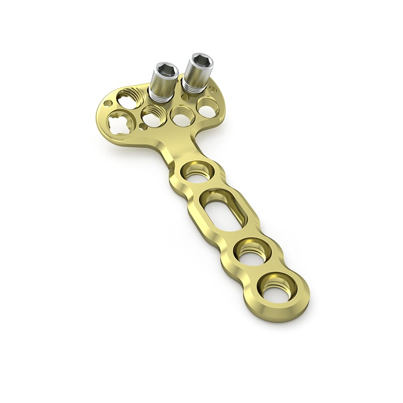 Advanced Locking Screw Technology for Superior Stability
