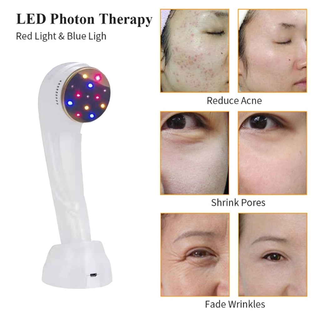 Fade Chloasma/Acne + Tighten Skin: Red/Blue/Yellow Laser for Collagen Activation