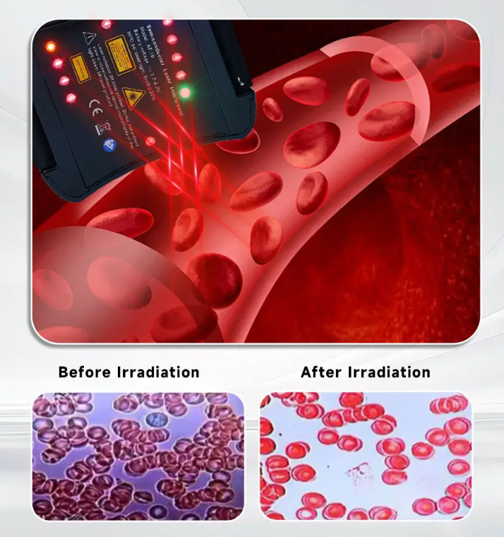 How to lower blood pressure naturally at home?