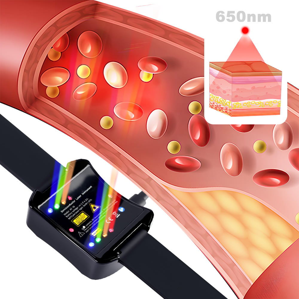 650nm LLLT Wrist Laser Support for Type II Diabetes, Atherosclerosis & Rhinitis