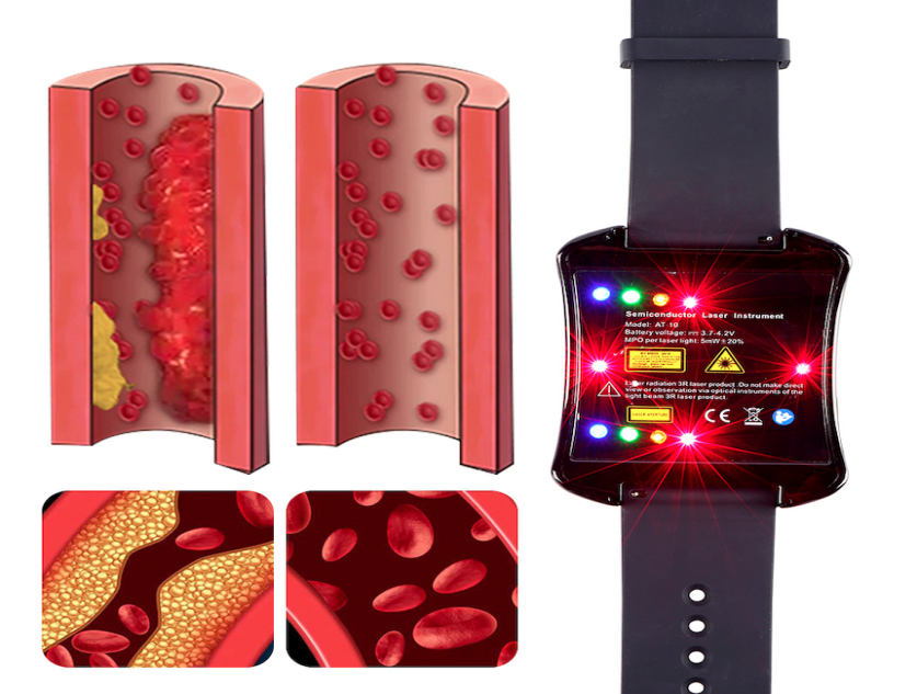 How to Lower Cholesterol Naturally with Innovative Health Devices