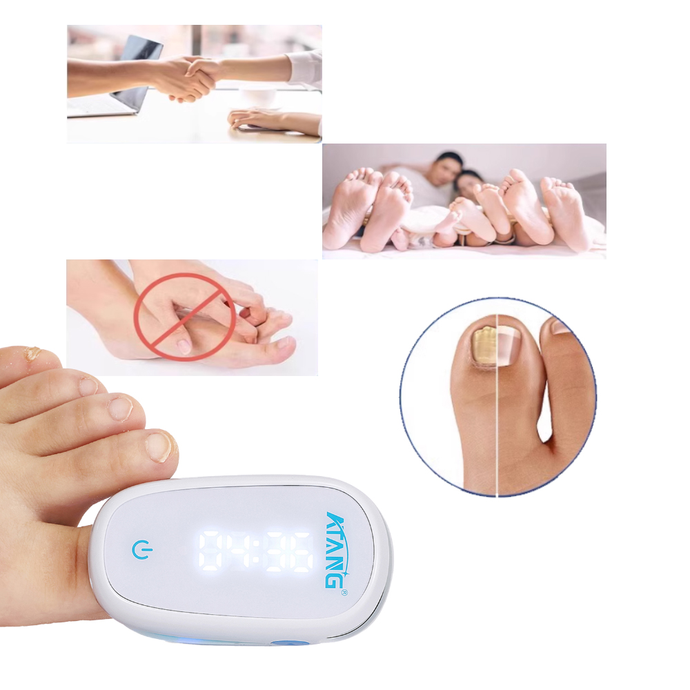 Cure Nail Infections Fast with Infrared Light Combined with Blue Light for Toenail Fungus