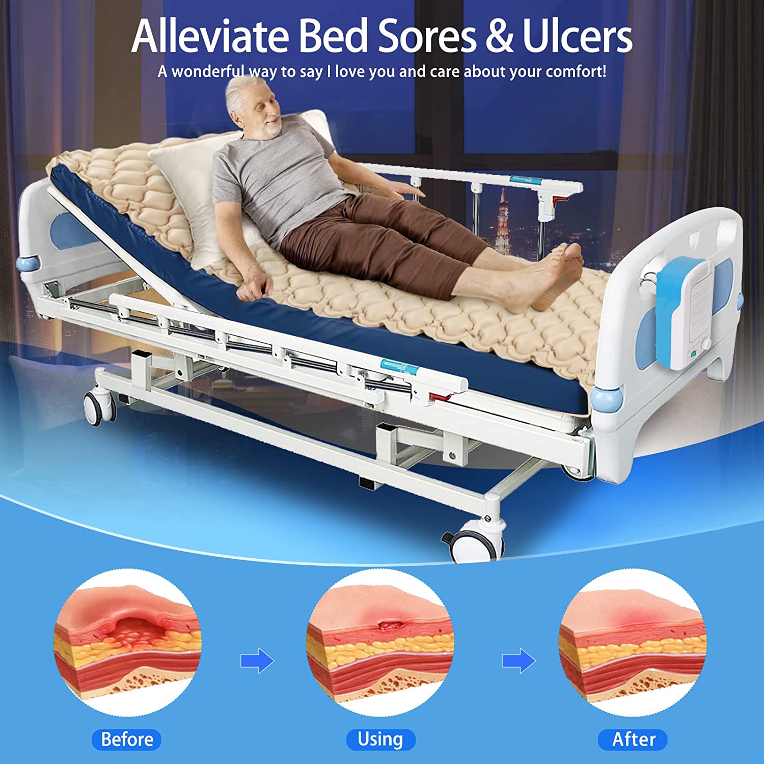 Wholesale Inflatable Bubble Anti Bedsore Decubitus Medical Alternating Pressure air Mattress for Hospital Bed
