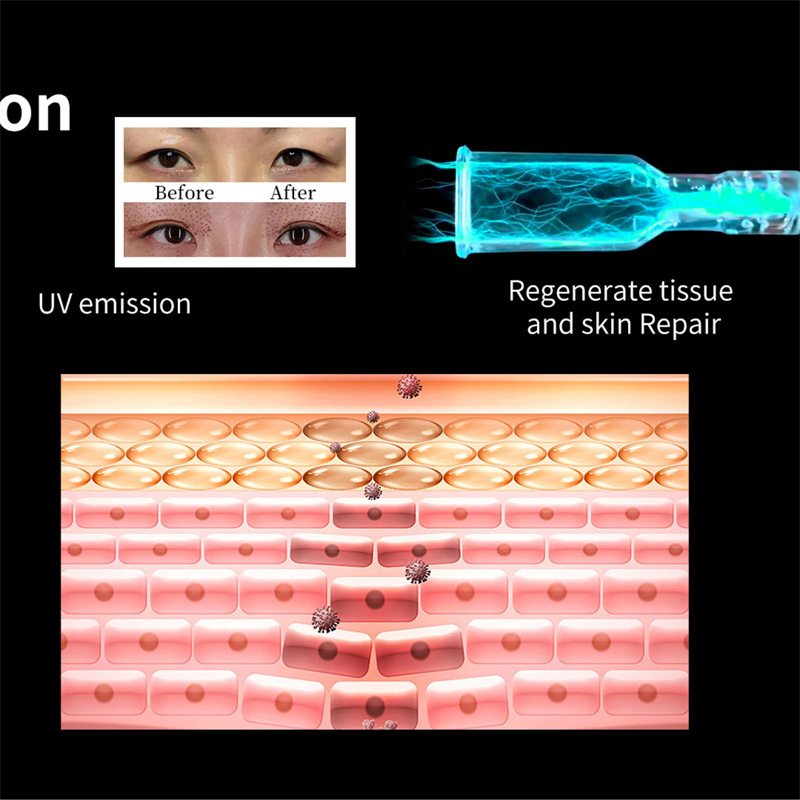 How Cold Plasma Devices Work for Sensitive Skin: A Gentle Approach to Rejuvenation