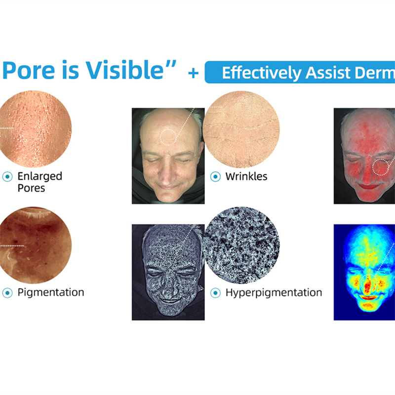 What Clinics Should Know About Modern Skin Analyzer Technology