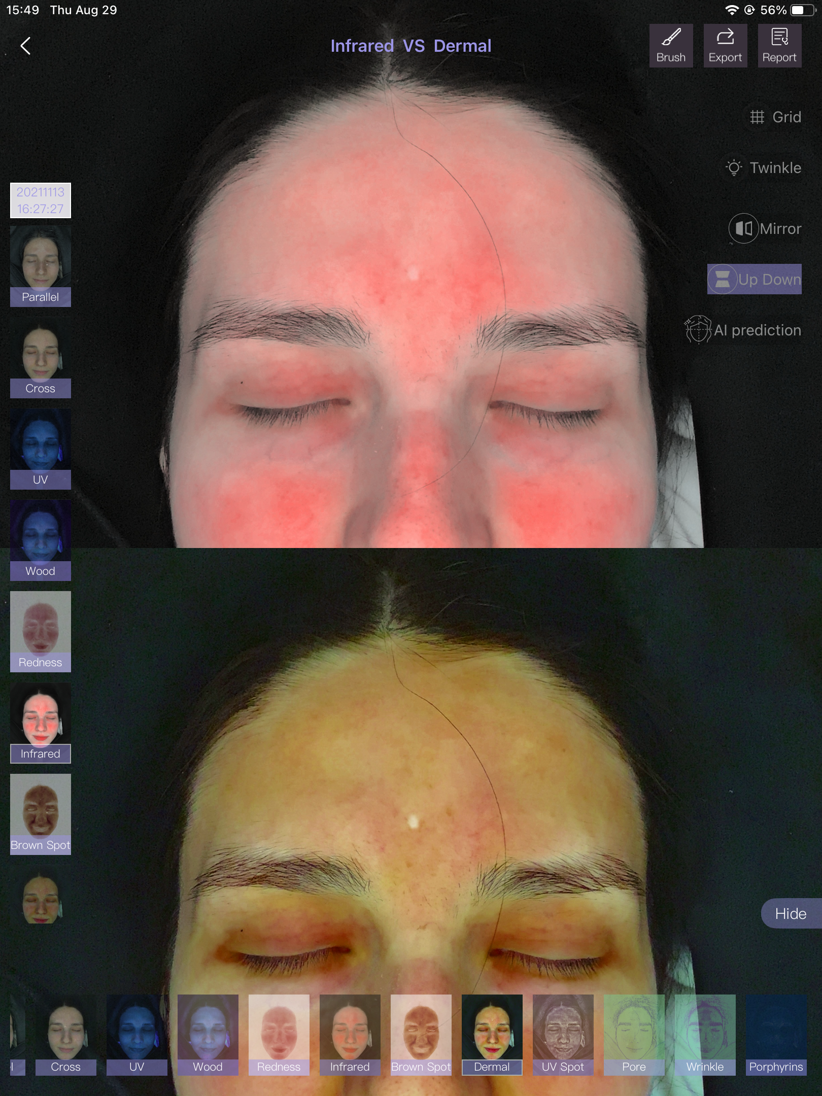 skin analyzer-0